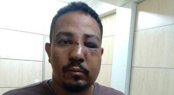 Homem é preso após agredir cartomante por não gostar de leitura de tarô