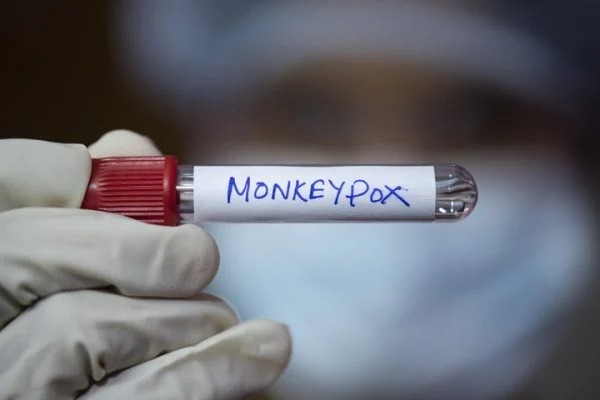Com 160 casos, Secretaria da Saúde confirma transmissão comunitária de Monkeypox em Goiás